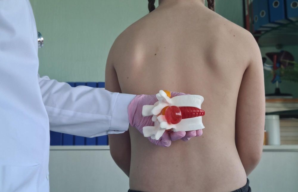 Vertebroplastia y Cifoplastia en Naucalpan: Tratamientos seguros para fracturas vertebrales