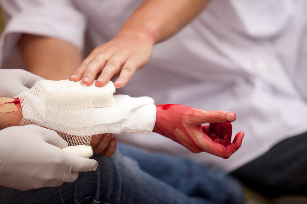 Manejo de heridas en Naucalpan: Cuidado profesional para una recuperación segura